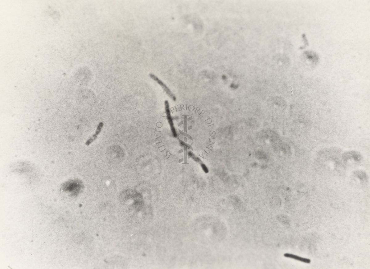 Differenti immagini del Batteriofago. Si tratta di un virus che infetta esclusivamente i batteri e sfrutta il loro apparato biosintetico per effettuare la replicazione virale.