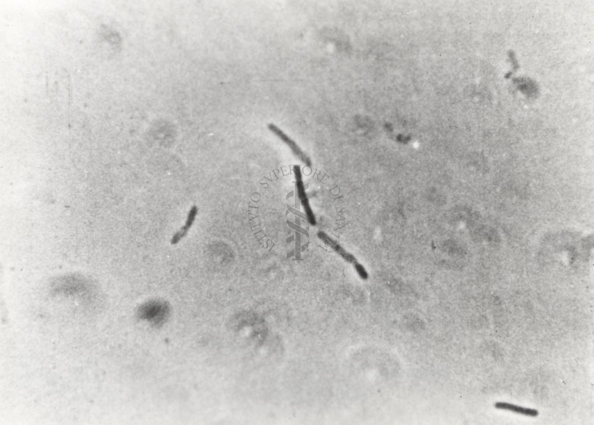 Differenti immagini del Batteriofago. Si tratta di un virus che infetta esclusivamente i batteri e sfrutta il loro apparato biosintetico per effettuare la replicazione virale.