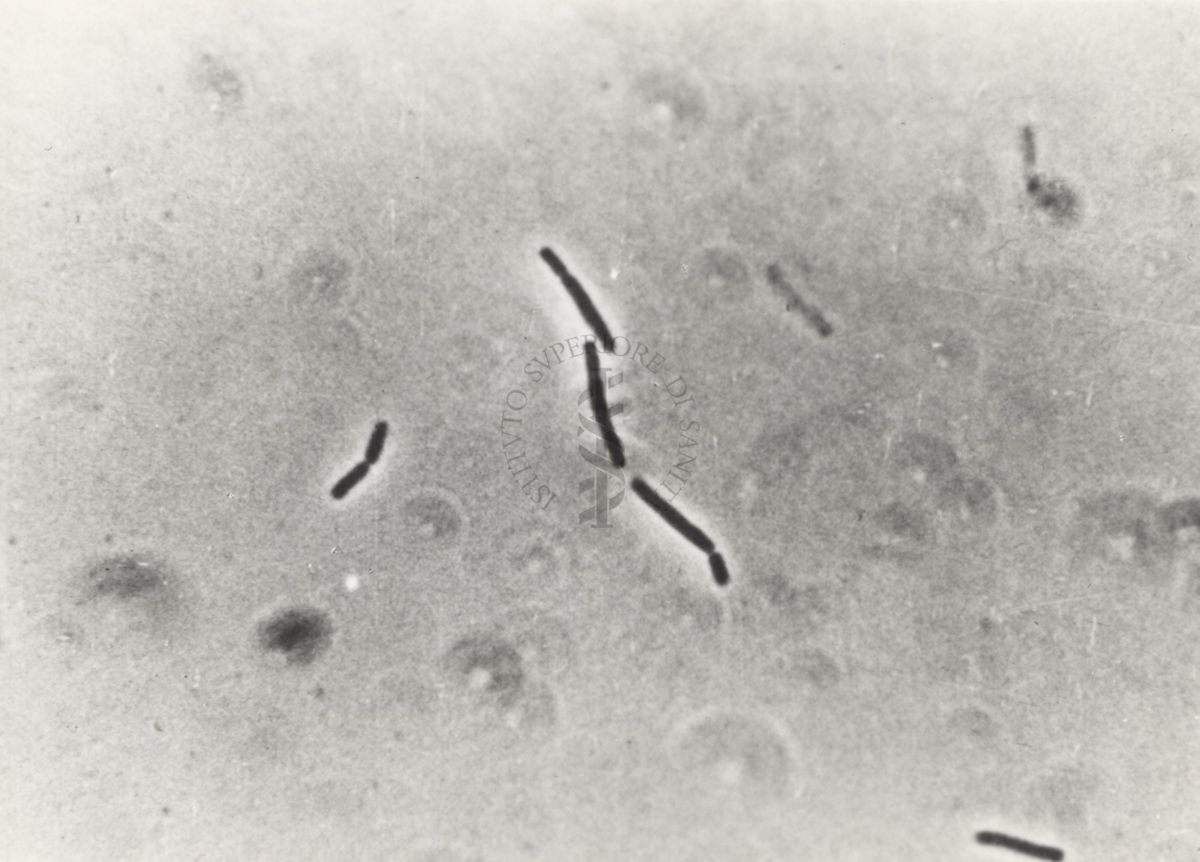 Differenti immagini del Batteriofago. Si tratta di un virus che infetta esclusivamente i batteri e sfrutta il loro apparato biosintetico per effettuare la replicazione virale.