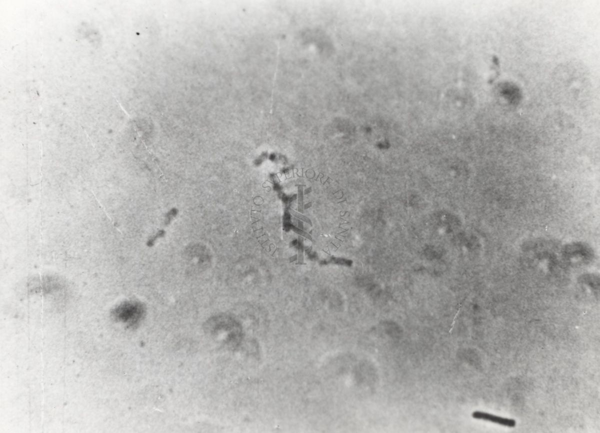 Differenti immagini del Batteriofago. Si tratta di un virus che infetta esclusivamente i batteri e sfrutta il loro apparato biosintetico per effettuare la replicazione virale.