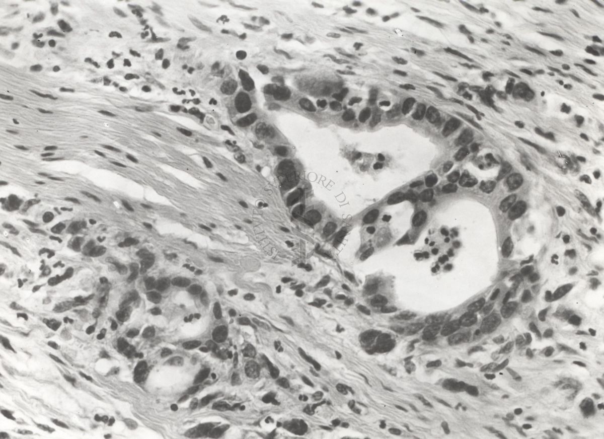 Studio istologico di una cellula argentaffine (struttura che si colora con i sali d'argento) dell'appendice