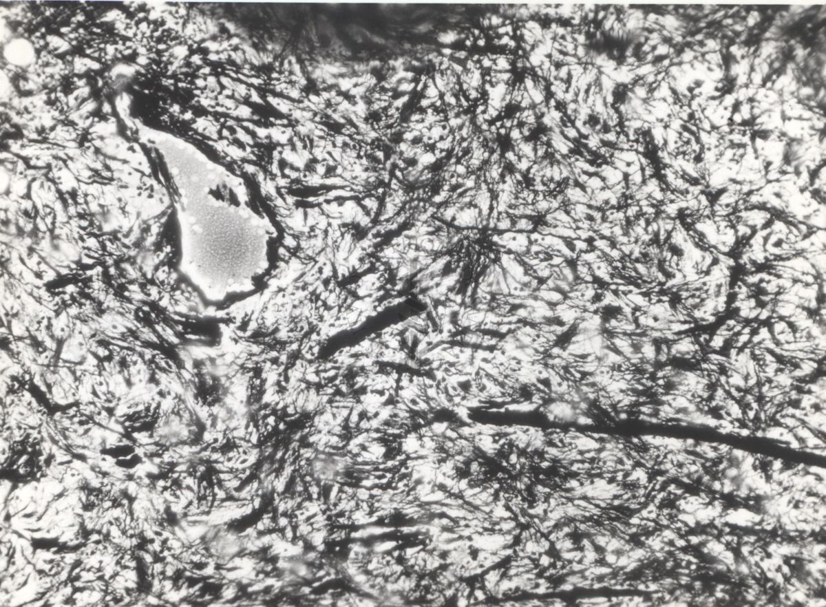 Studio istologico di una cellula argentaffine (struttura che si colora con i sali d'argento) dell'appendice