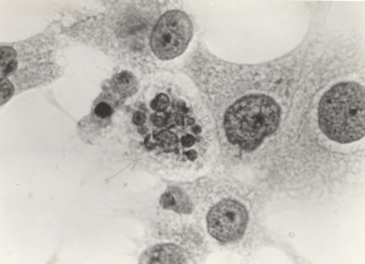 Cellula tipo "H" da coltura in vitro del ceppo KB.