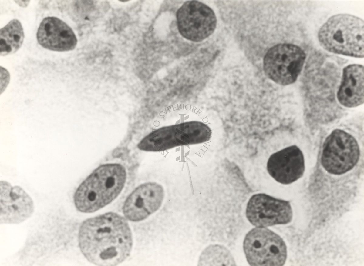 Cellula tipo "H1" da coltura in vitro del ceppo di fegato umano