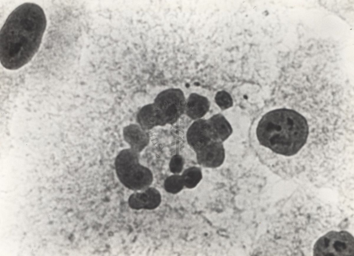 Cellula tipo "G1" da coltura in vitro del ceppo KB.