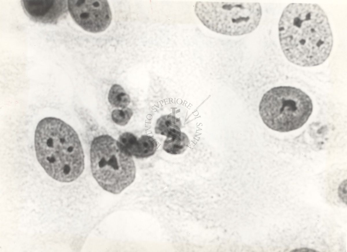 Cellula tipo "E1" da coltura in vitro del ceppo del rene umano PF.