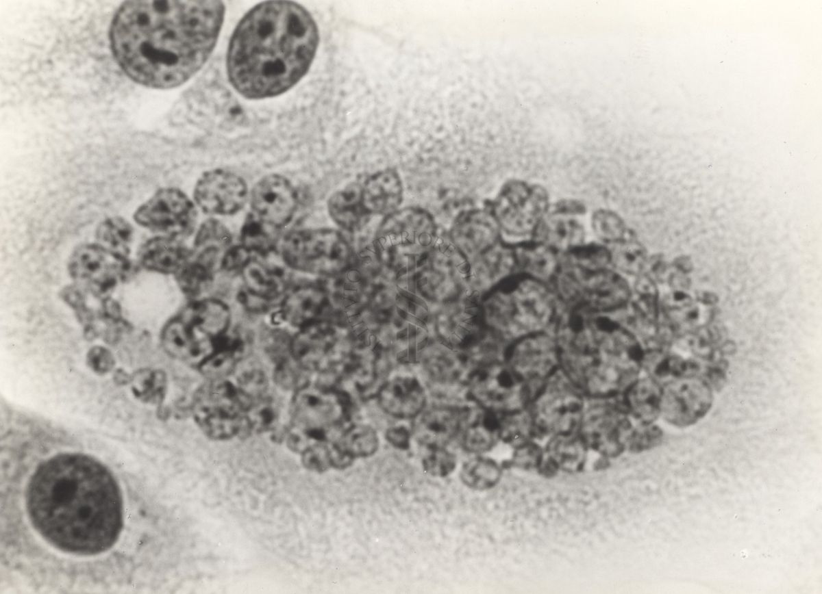 Cellula tipo "H" da coltura in vitro del ceppo KB.