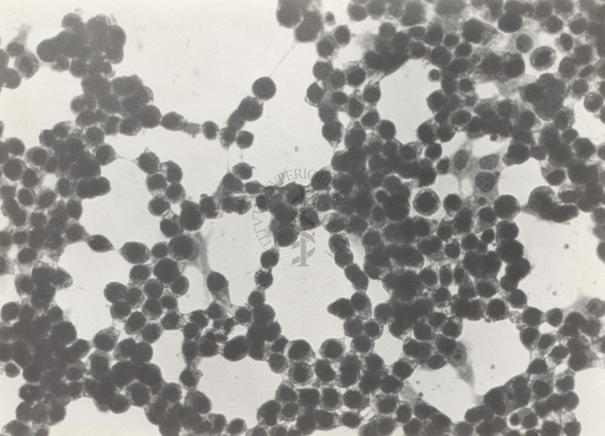 Tossina Clostridium cedematicus. Cellule del fegato.