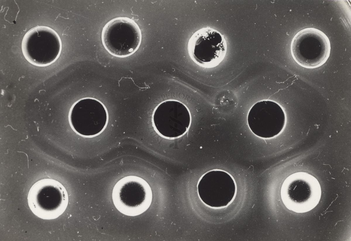 Immunoelettroforesi in agar. Si tratta di una tecnica generalmente usata per analizzare e separare acidi nucleici.