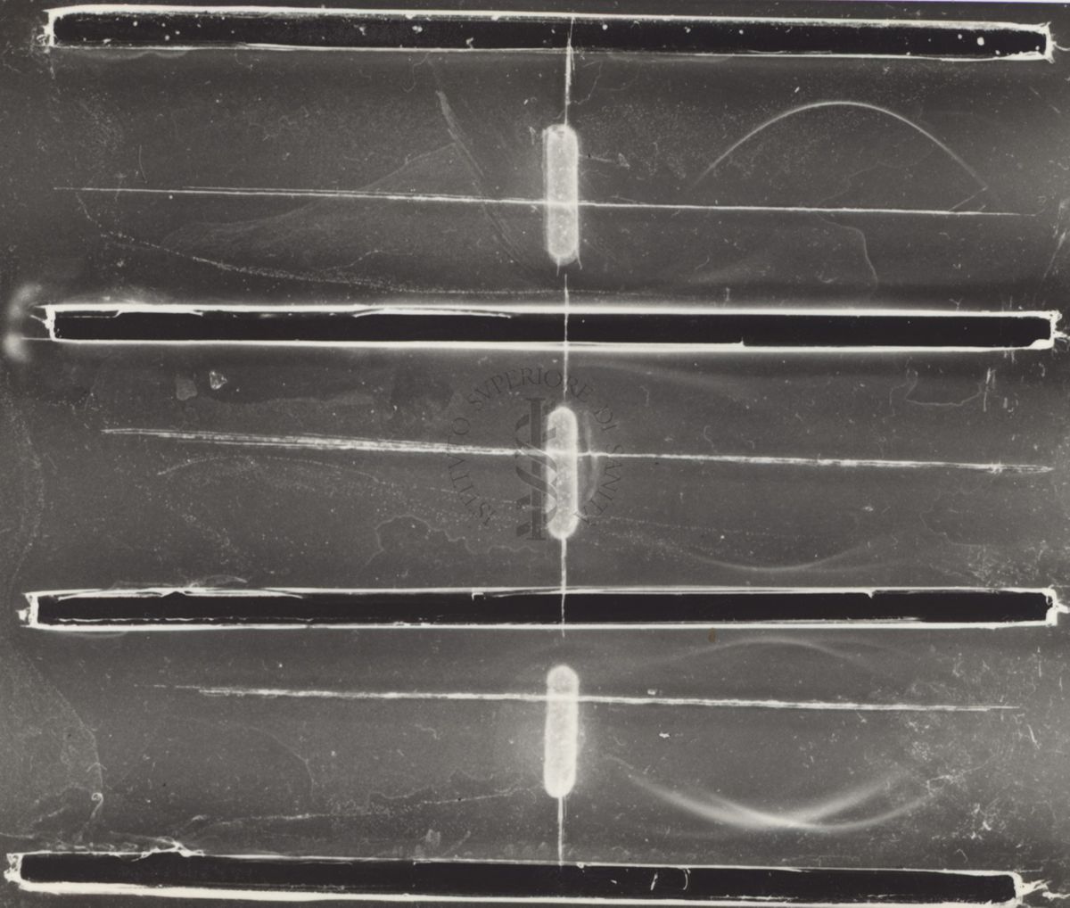 Immunoelettroforesi di micobatteri