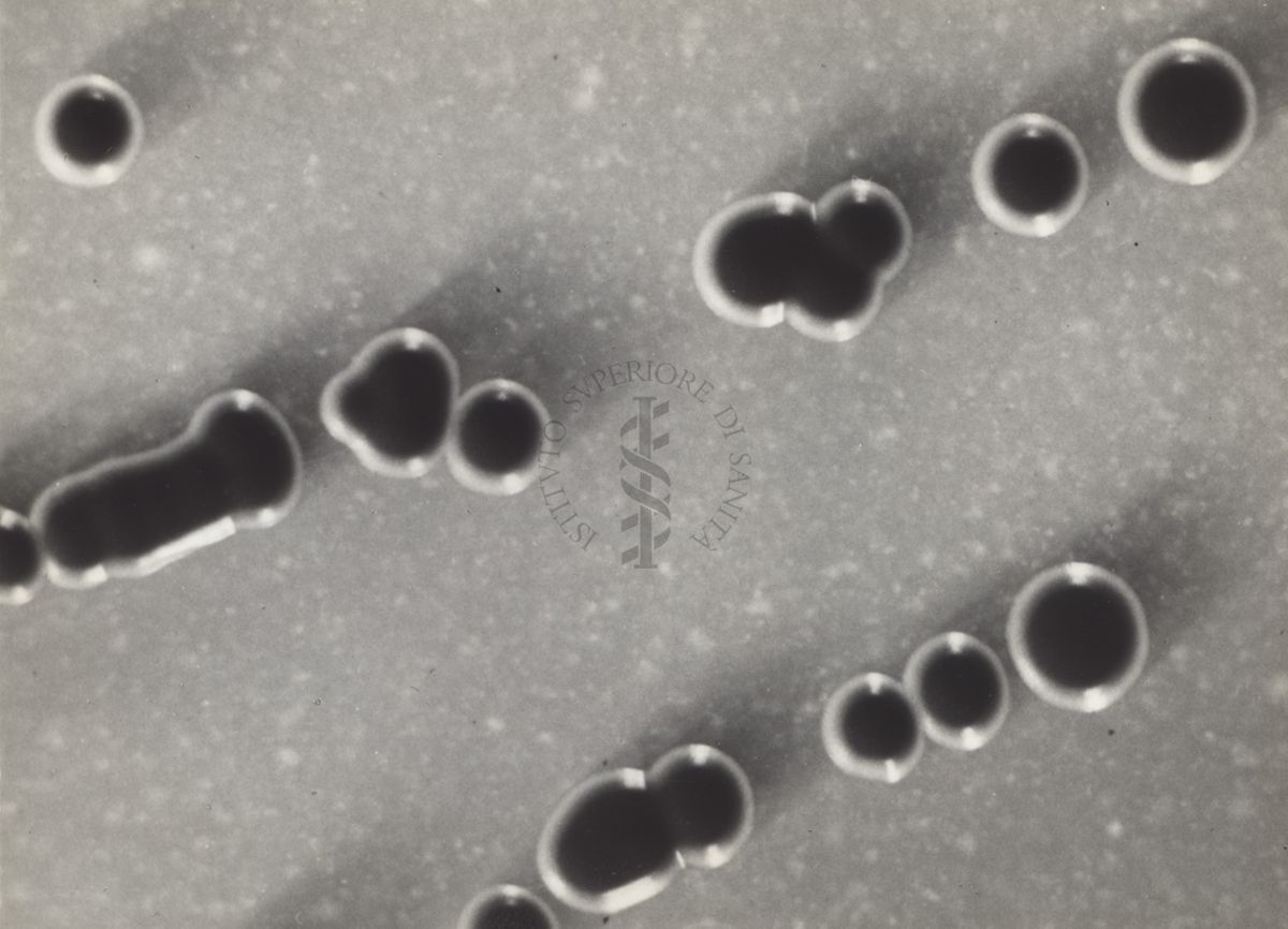 Fotografie di Corynebacterium diphtheriae