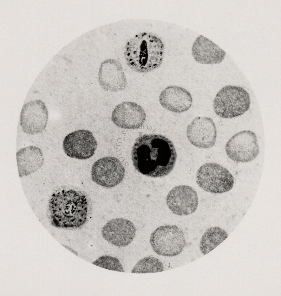 Schizonti di Plasmodium vivax