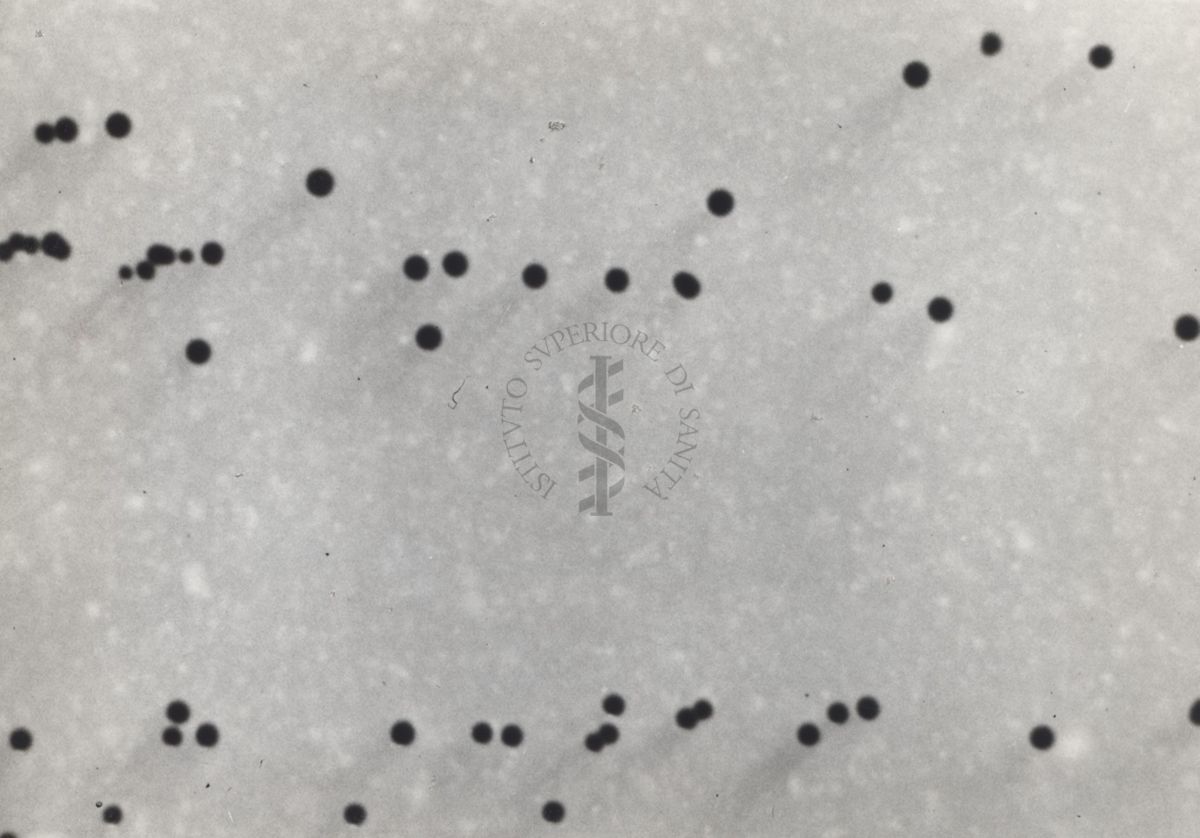 Fotografie di Corynebacterium diphtheriae