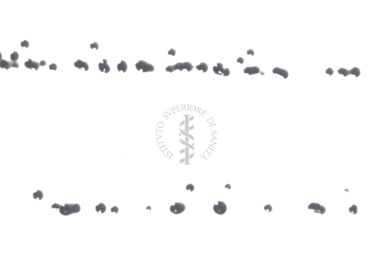 Fotografie di Corynebacterium diphtheriae