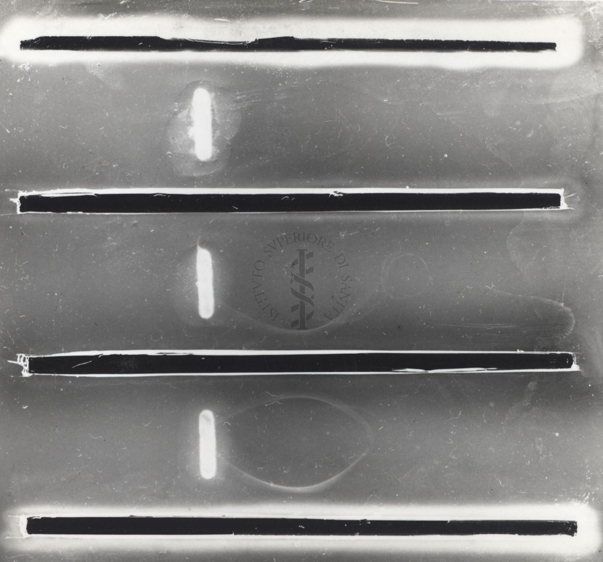 Immunoelettroforesi di micobatteri