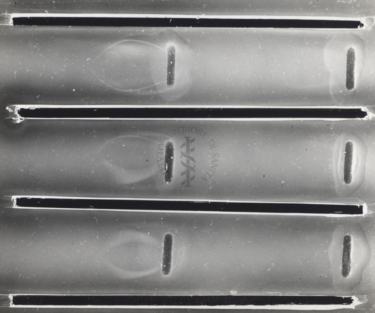 Immunoelettroforesi di micobatteri