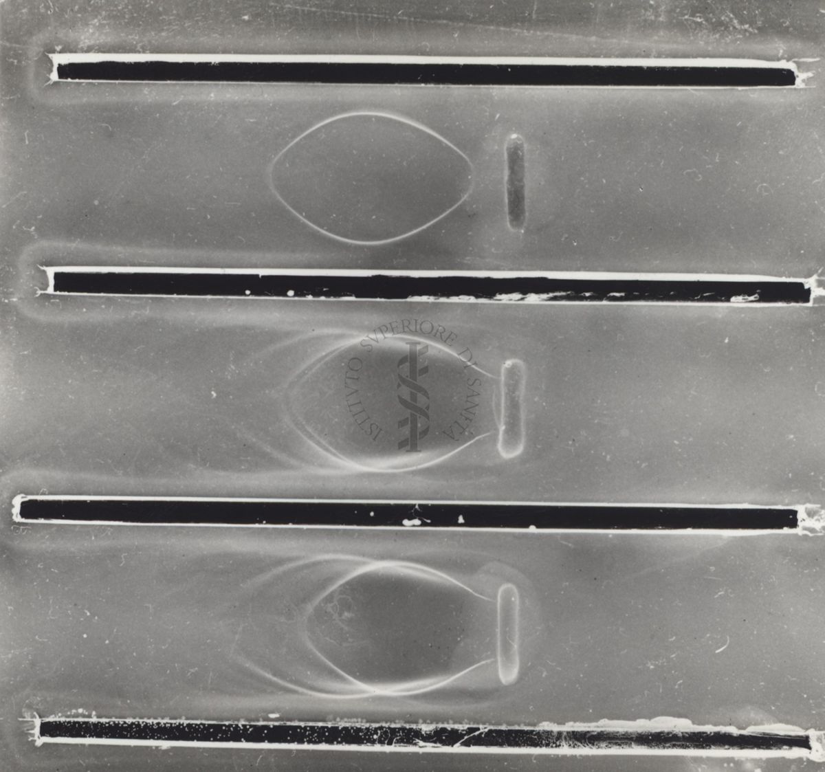 Immunoelettroforesi di micobatteri