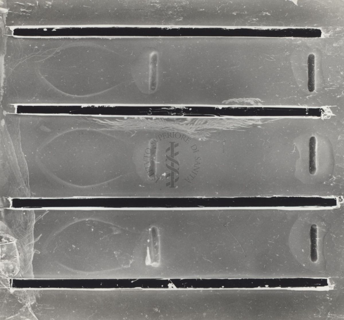 Immunoelettroforesi di micobatteri