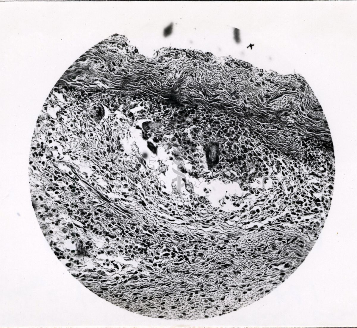 Siero antireticolare intotossico - tubercolo cavia inoculato con materiale specifico e trattata con A.C.S.