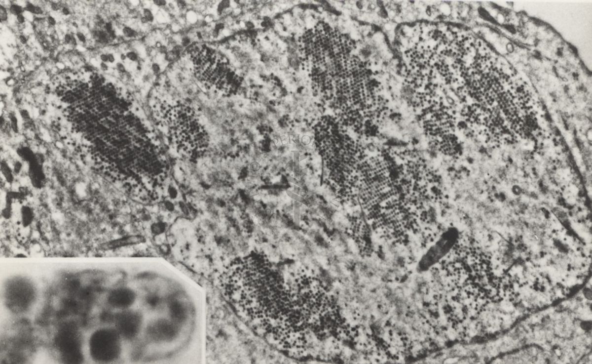 Sezioni osservate al Microscopio Elettronico