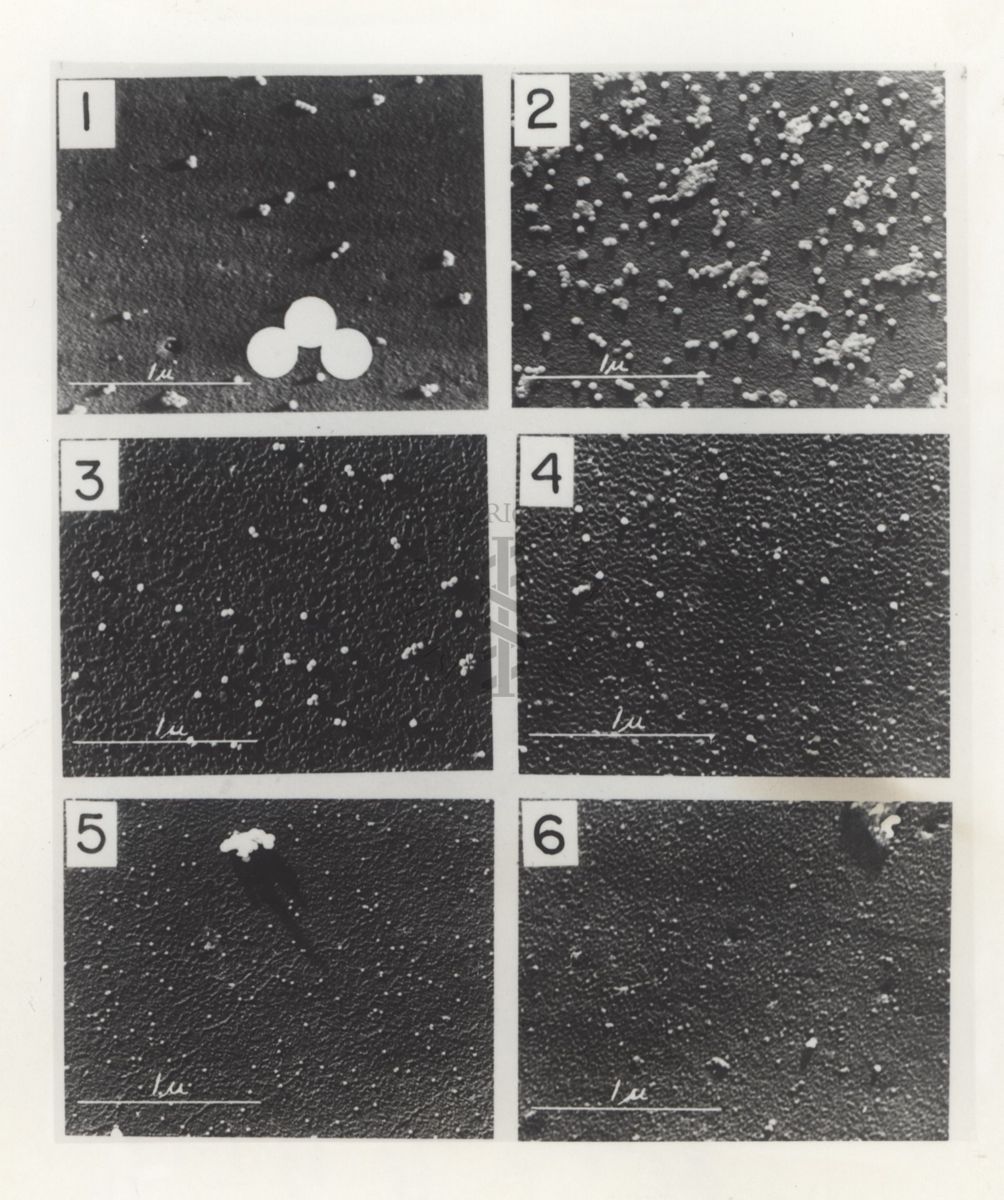 Sezioni osservate al Microscopio Elettronico