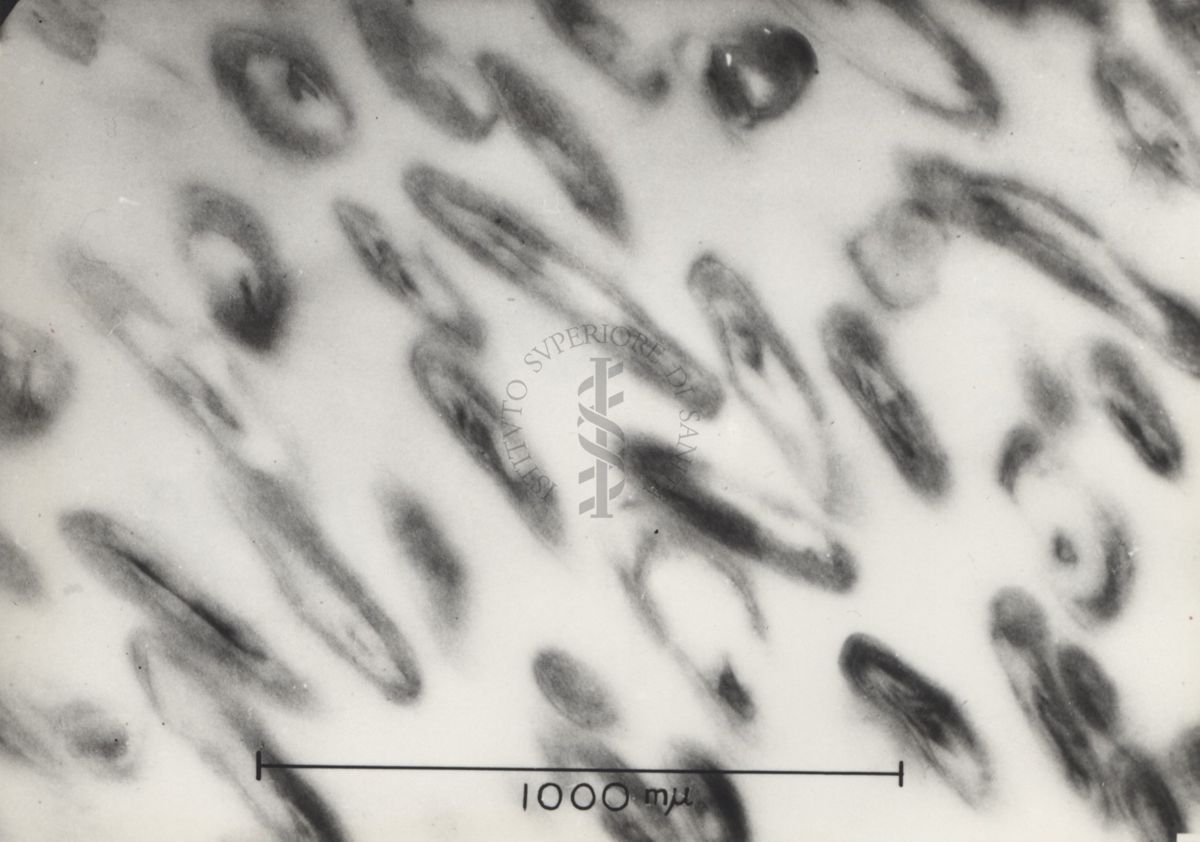 Sezioni osservate al Microscopio Elettronico