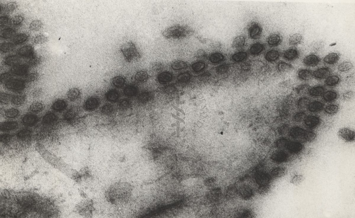 Sezioni osservate al Microscopio Elettronico