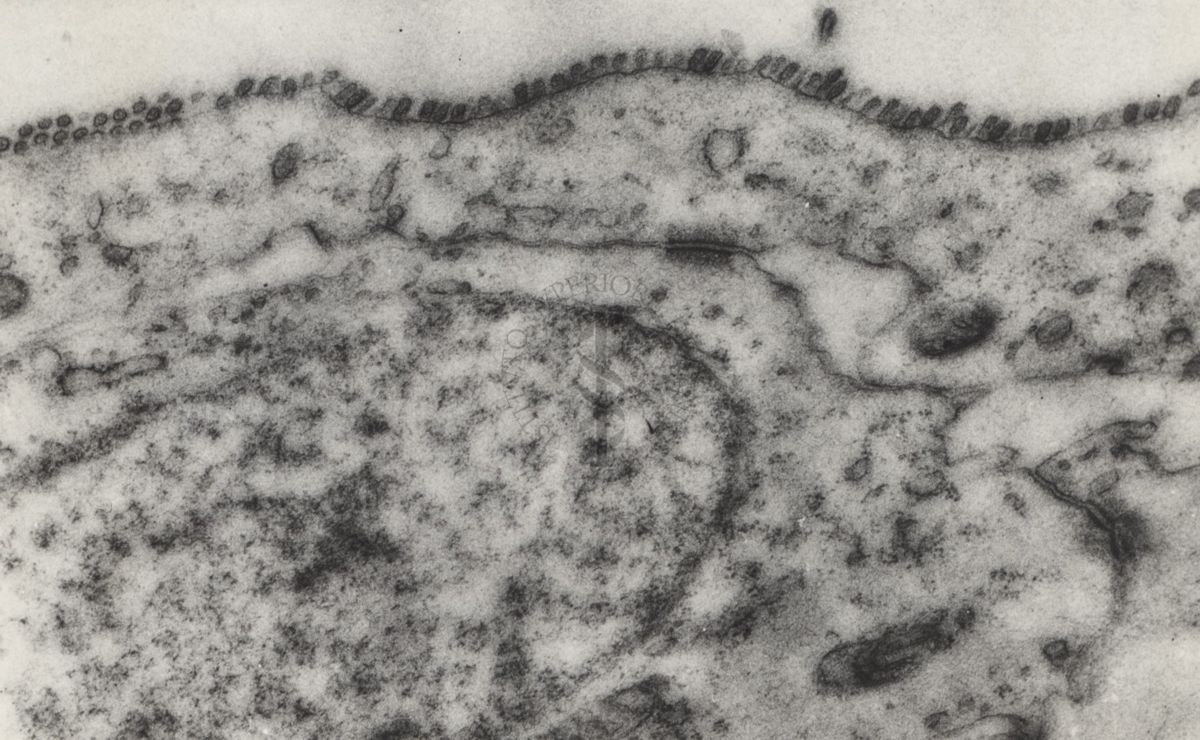 Sezioni osservate al Microscopio Elettronico