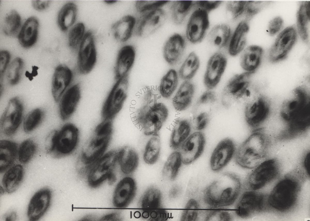 Sezioni osservate al Microscopio Elettronico