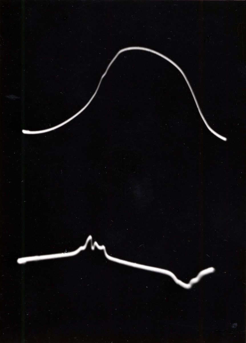 Oscillogramma della colchicina con ph 3,17