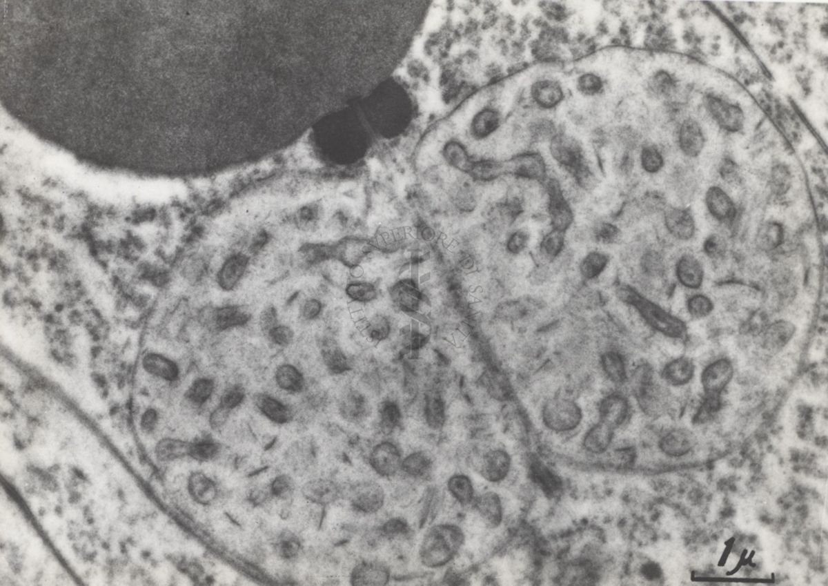 La spermatogenesi studiata al Microscopio elettronico