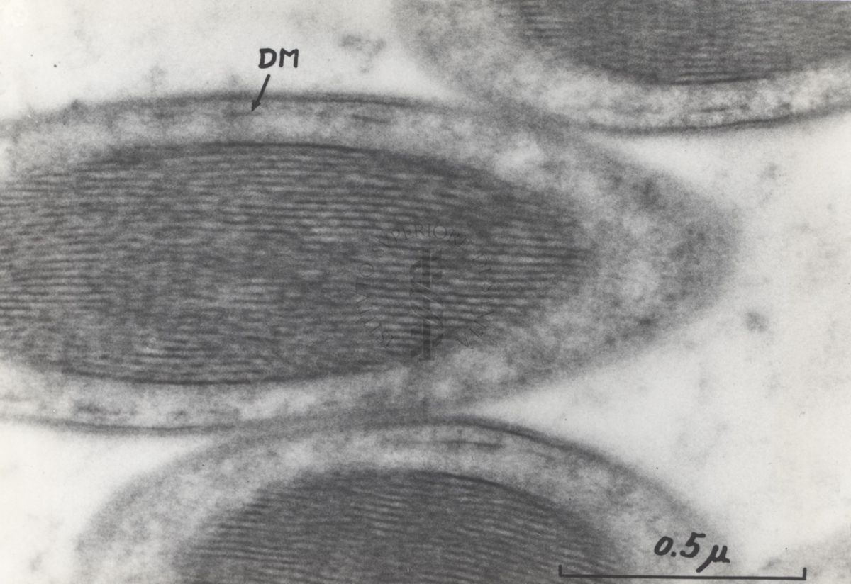 La spermatogenesi studiata al Microscopio elettronico