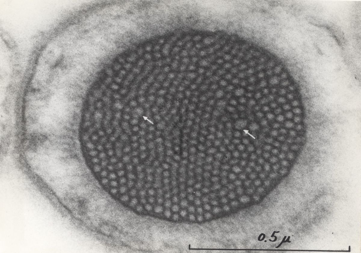 La spermatogenesi studiata al Microscopio elettronico