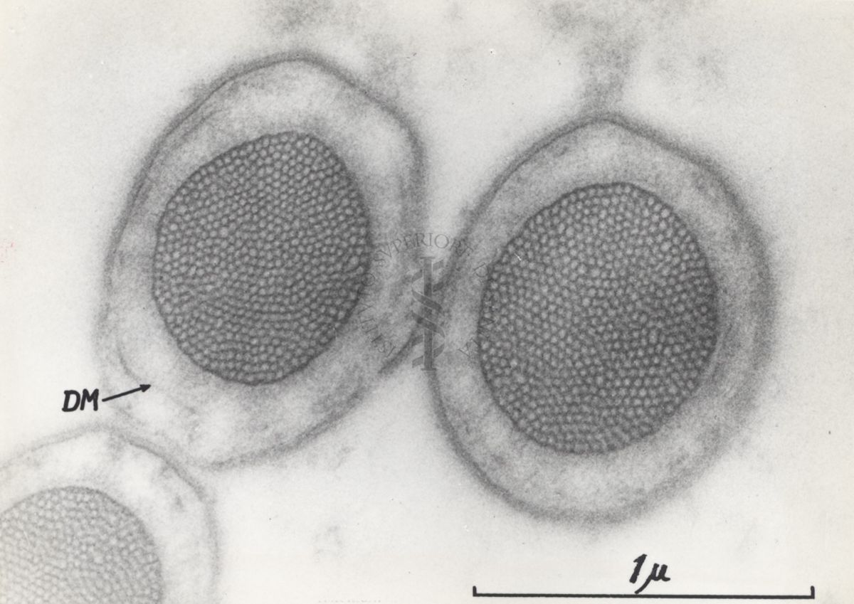 La spermatogenesi studiata al Microscopio elettronico