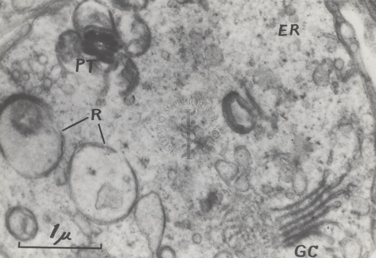 La spermatogenesi studiata al Microscopio elettronico