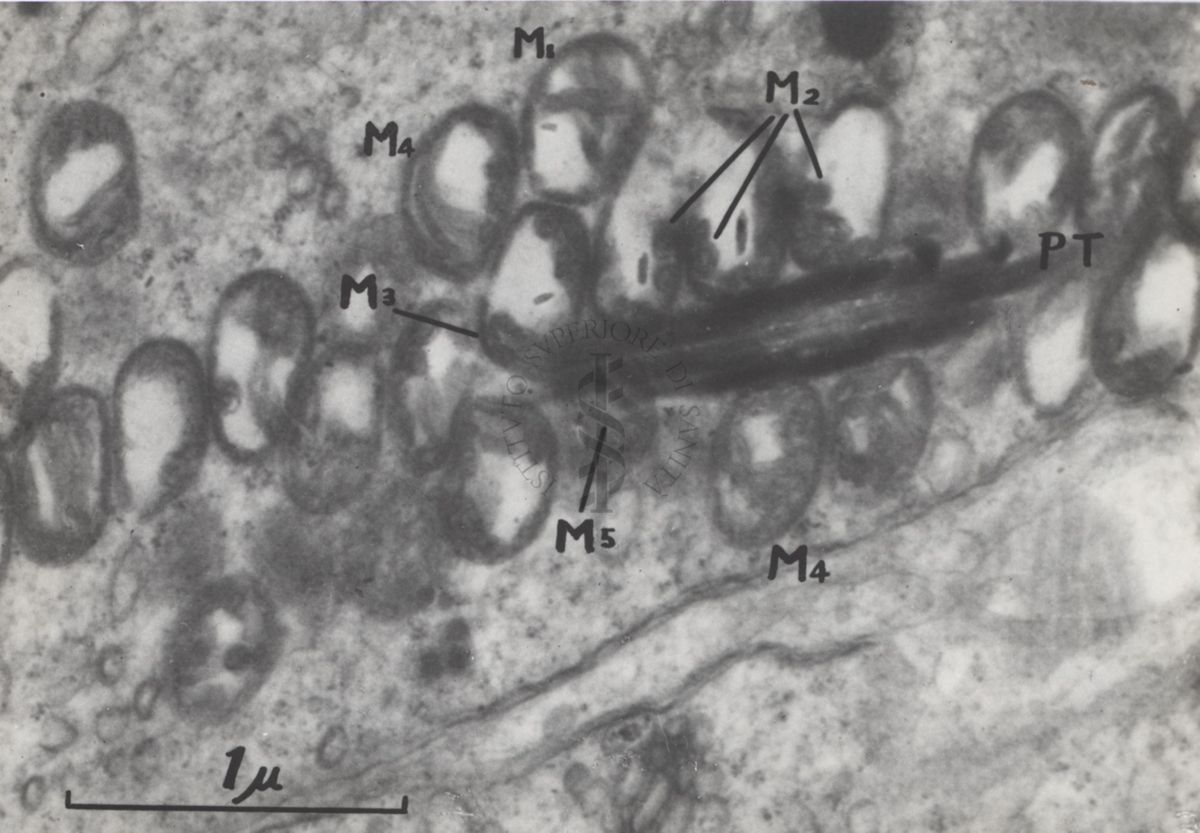 La spermatogenesi studiata al Microscopio elettronico