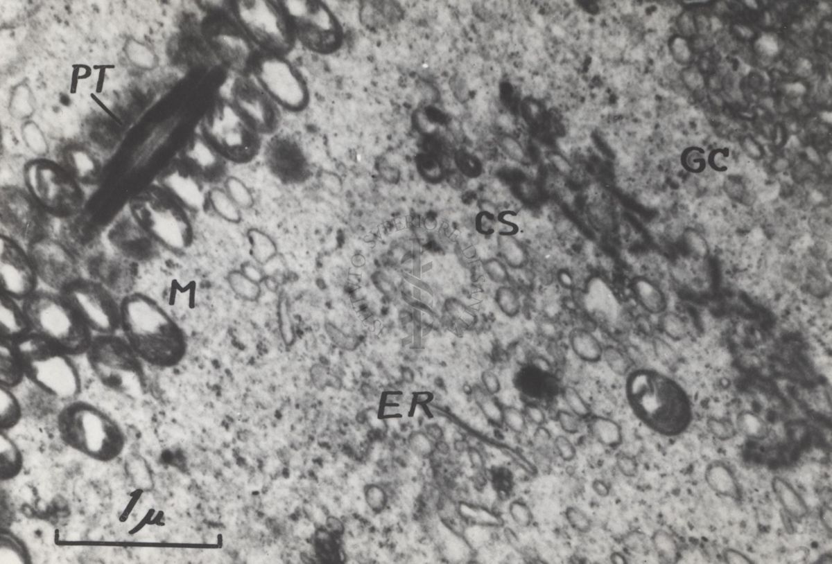 La spermatogenesi studiata al Microscopio elettronico