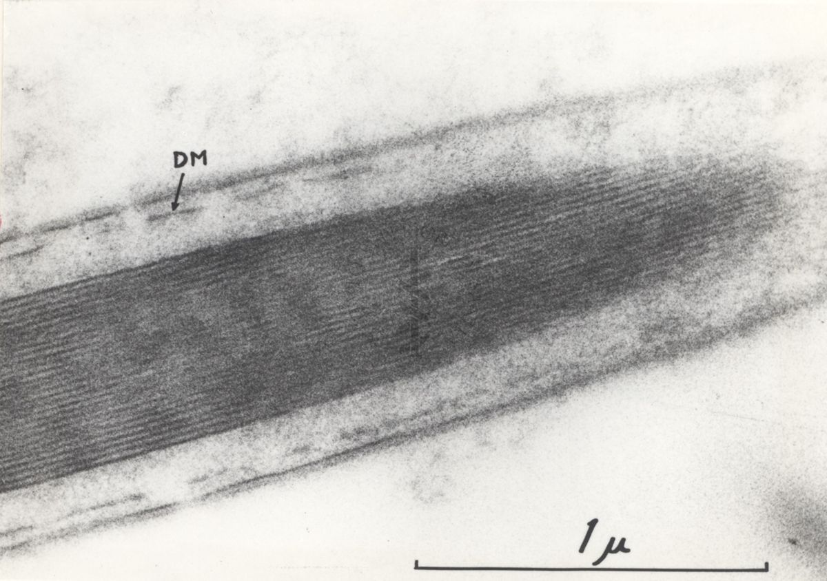 La spermatogenesi studiata al Microscopio elettronico