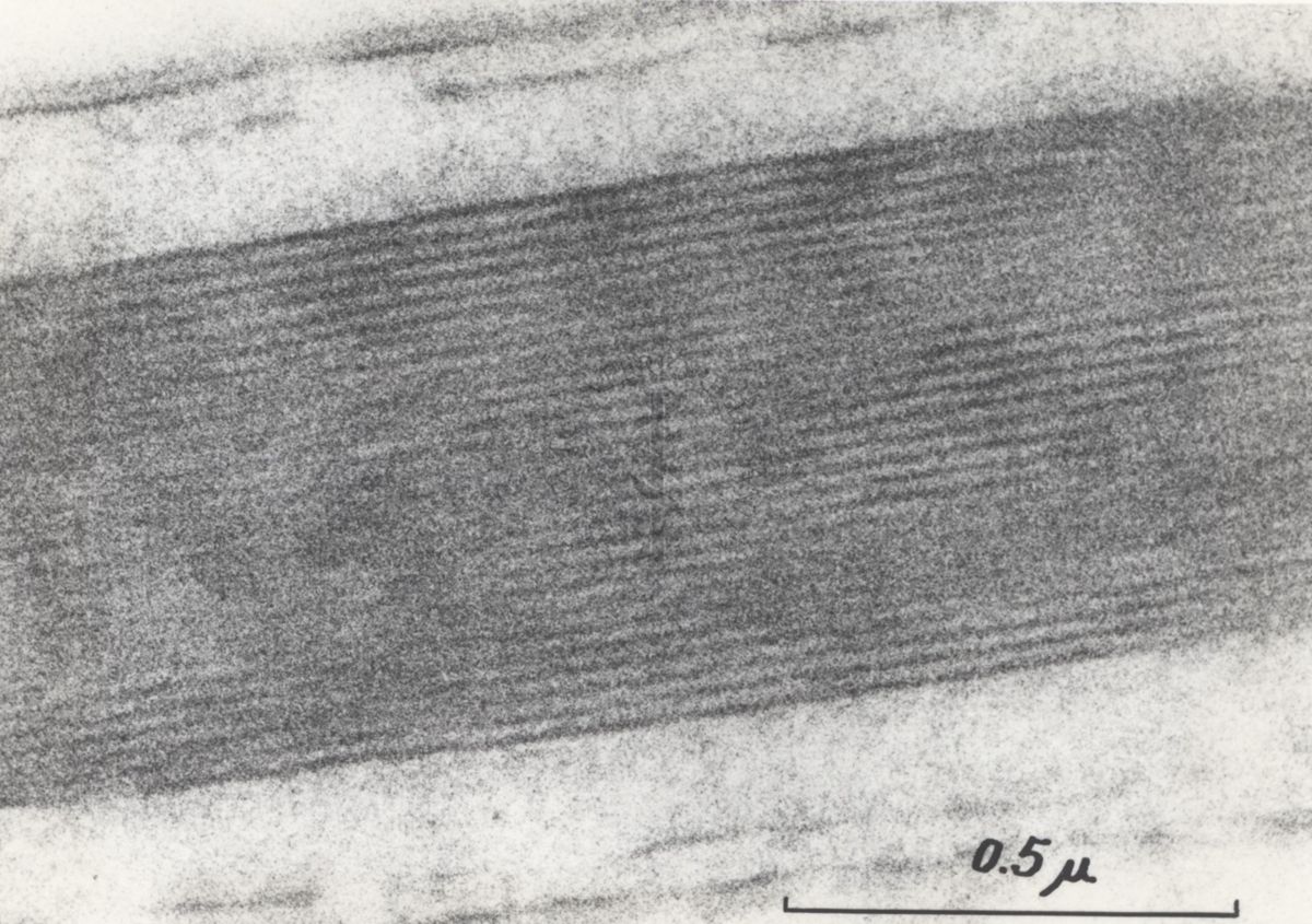 La spermatogenesi studiata al Microscopio elettronico