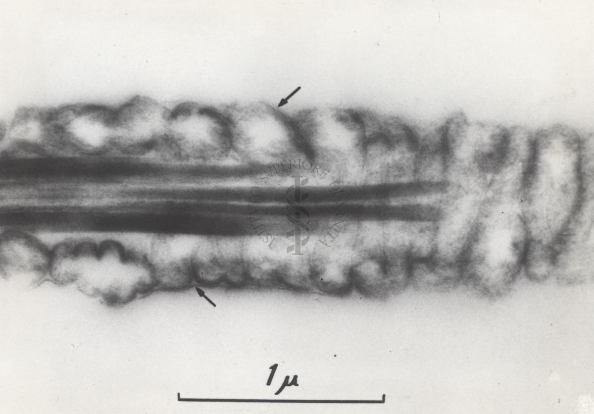 La spermatogenesi studiata al Microscopio elettronico