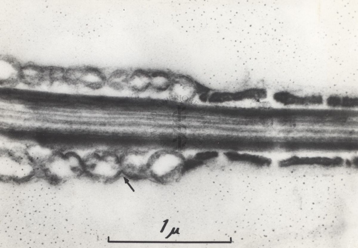 La spermatogenesi studiata al Microscopio elettronico