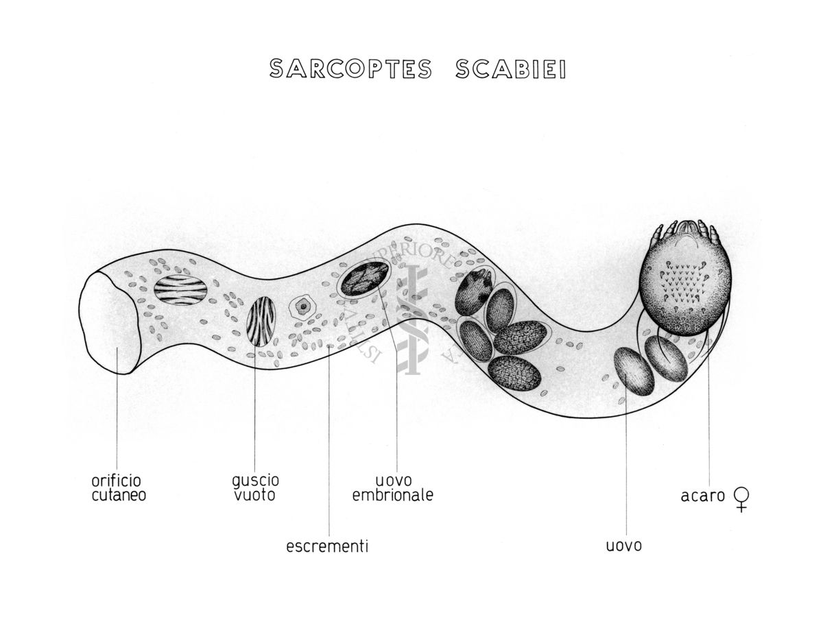 Disegno: Sarcoptes Scabiei