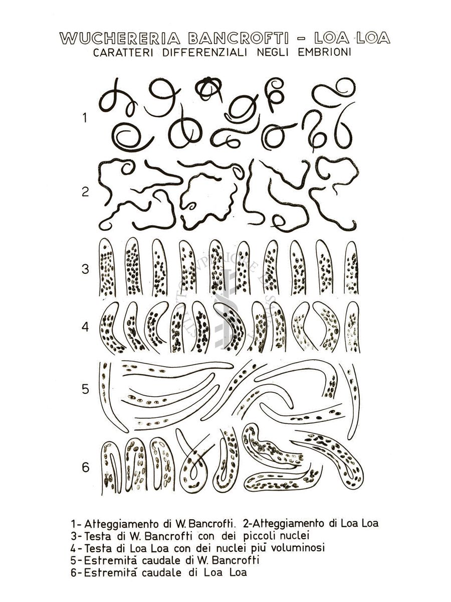 Disegno: Wuchereria Bancrofti - Loa Loa (caratteri differenziali negli embrioni)