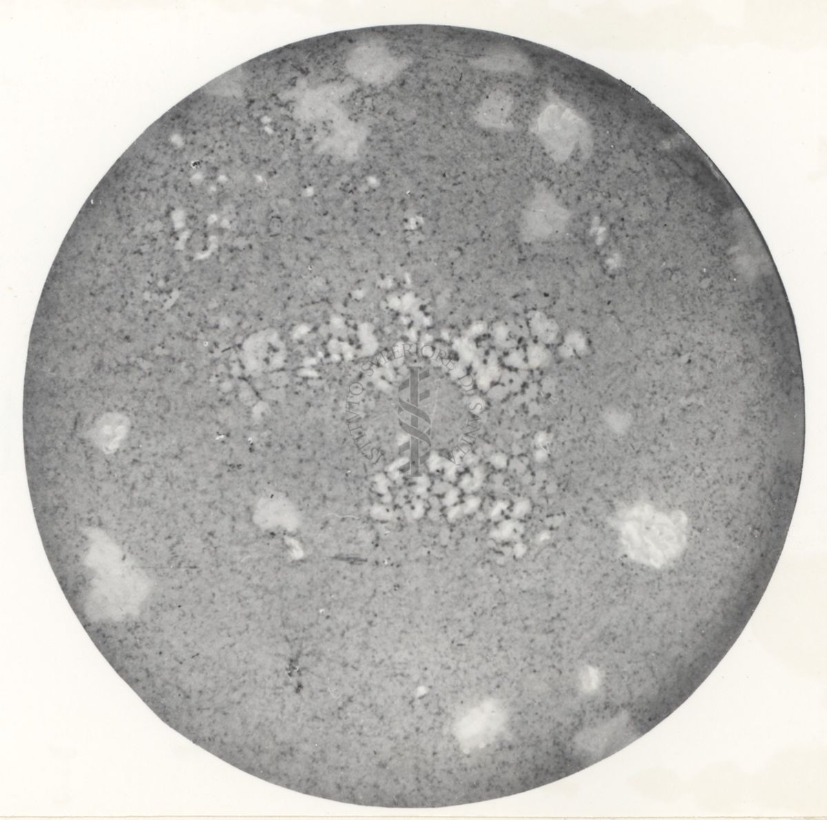 Immagine al microscopio di coltura in piastra