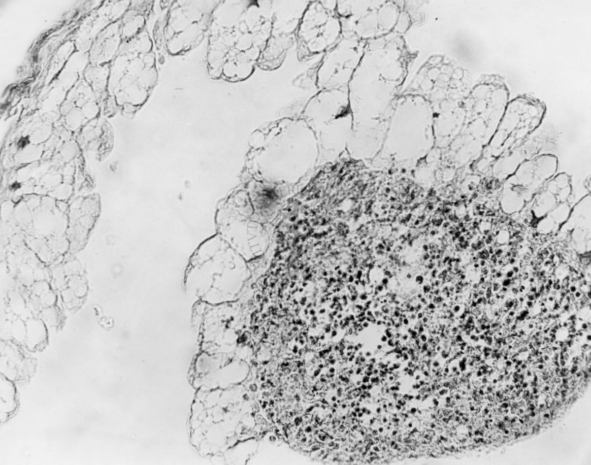 Embrioni inoculati con materiale leucemico umano con e senza filtrazioni da Scitz. Controlli relativi