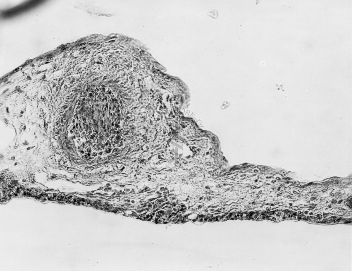 Embrioni inoculati con materiale leucemico umano con e senza filtrazioni da Scitz. Controlli relativi