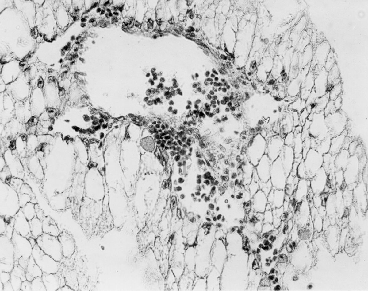 Embrioni inoculati con materiale leucemico umano con e senza filtrazioni da Scitz. Controlli relativi