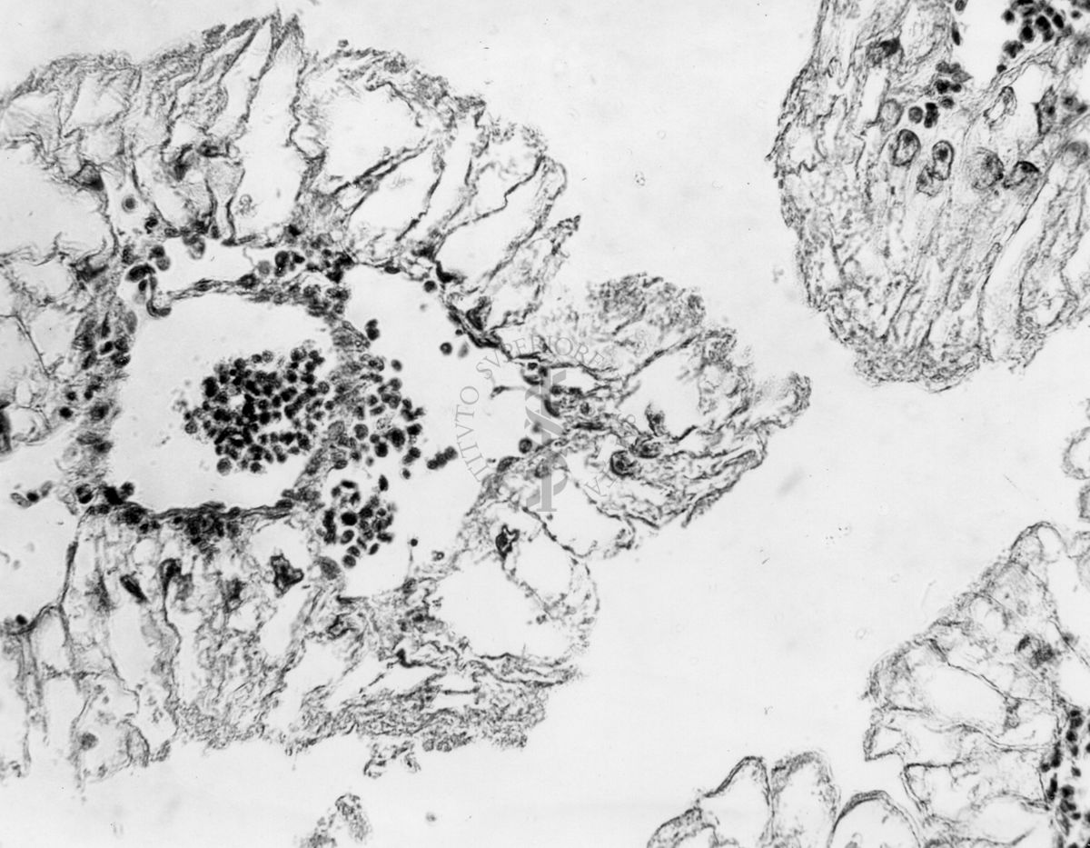 Embrioni inoculati con materiale leucemico umano con e senza filtrazioni da Scitz. Controlli relativi