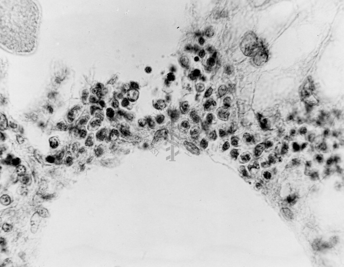 Embrioni inoculati con materiale leucemico umano con e senza filtrazioni da Scitz. Controlli relativi