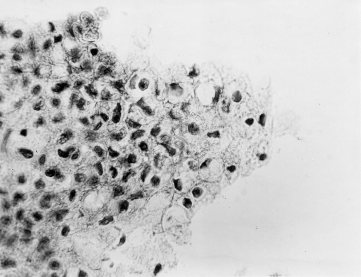 Embrioni inoculati con materiale leucemico umano con e senza filtrazioni da Scitz. Controlli relativi